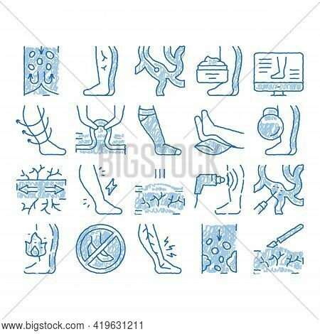 Varicose Veins Disease Sketch Icon Vector. Hand Drawn Blue Doodle Line Art Varicose Symptoms And Tre