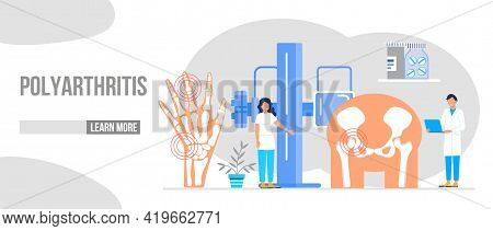 Rheumatoid Arthritis Of The Foot. Tiny Doctors Treat Rheumatism, Osteoarthritis, Make Ultrasound, X 