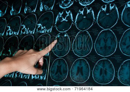 research in medicine. CT scan of the patient