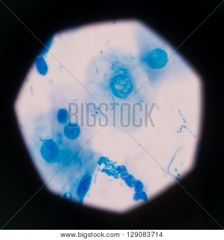 background Blue bacteria in gram stain sputum.