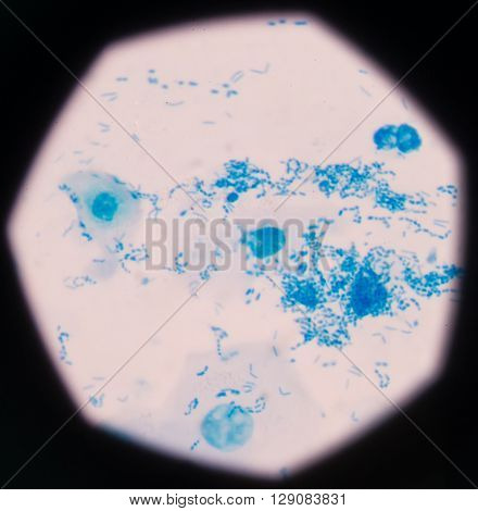 background Blue bacteria in gram stain sputum.