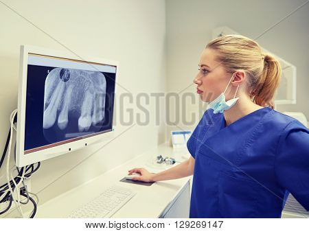 people, medicine, stomatology, technology and health care concept - female dentist looking to x-ray scan on monitor at dental clinic