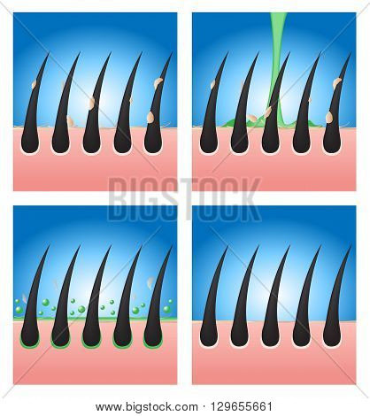 hair conditioner demonstration vector 4 versions on blue background