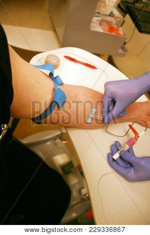 
phlebotomist draws blood from a patients arm for lab test. blood draw.  