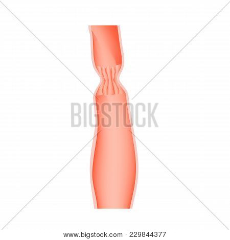Upper Sphincter Of Esophagus. Infographics. Vector Illustration On Isolated Background