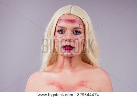Surgery Victim Beauty Drawing Line Make Up Face Female Before Operation Syringe.halloween Concept