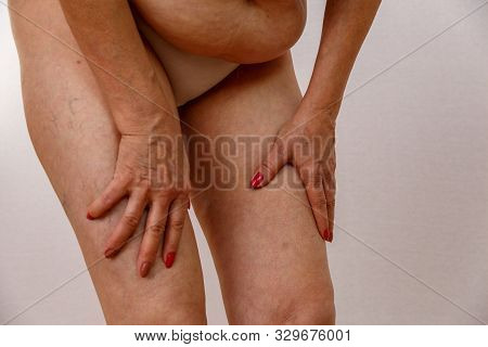 An Elderly Woman In White Panties Shows The Folds On Her Abdomen On A White Isolated Background.