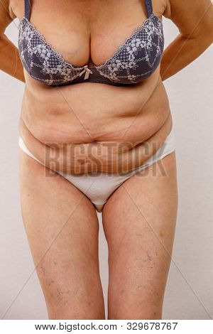 An Elderly Woman In White Panties Shows The Folds On Her Abdomen On A White Isolated Background.