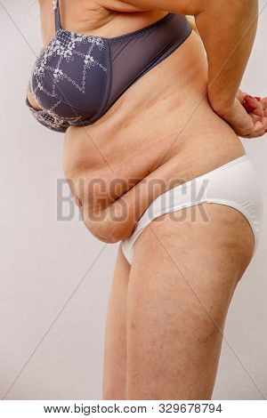 An Elderly Woman In White Panties Shows The Folds On Her Abdomen On A White Isolated Background.