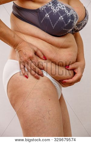 An Elderly Woman In White Panties Shows The Folds On Her Abdomen On A White Isolated Background.