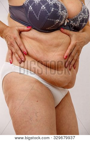 An Elderly Woman In White Panties Shows The Folds On Her Abdomen On A White Isolated Background.