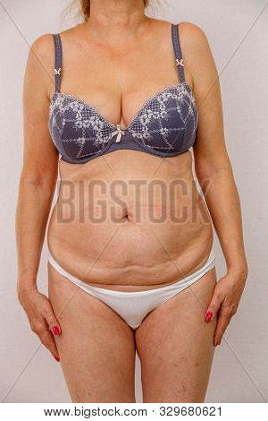 An Elderly Naked Woman Shows Her Body From All Sides. You Can See All The Nuances Of The Elderly Bod