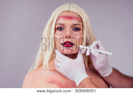 Attractive Long Hair Blonde Woman With Scars On Face Is Prepared For Operation Studio White Backgrou