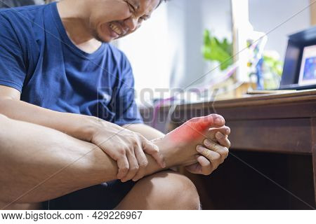 Man With Painful And Inflamed Gout On His Foot Around The Big Toe Area.