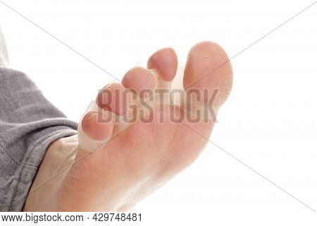 Bare Feet In Bunion Correctors For Treat Pain In Hallux Valgus On White Background.