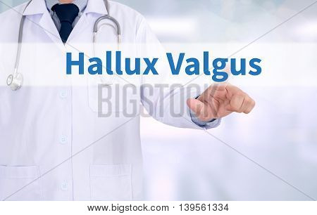 Hallux Valgus