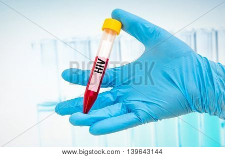 Test-tube With Blood Sample For Hiv Or Aids Test
