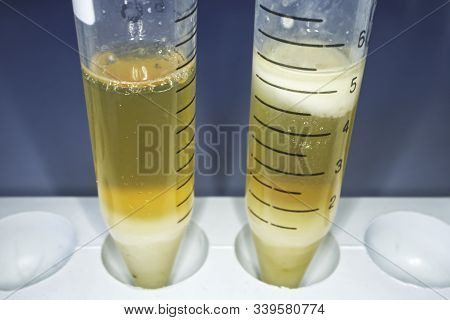 Sample Food Lysate For Dna Extraction In A 15 Ml Tube.