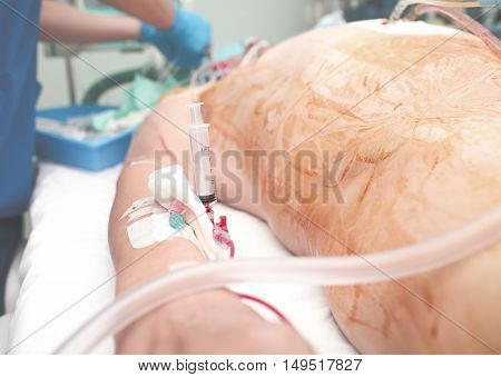 Blood sample and postoperative patient care in ICU