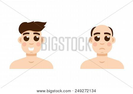 Hair Stages Loss. Types Of Baldness On Male Head Vector.
