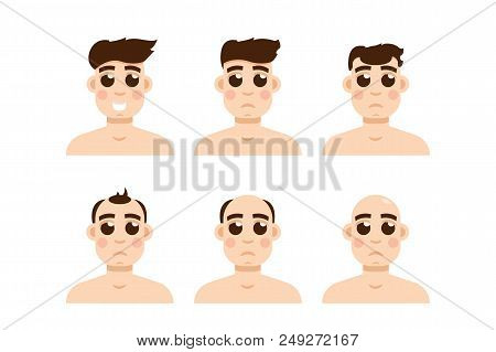 Hair Stages Loss. Types Of Baldness On Male Head Vector.