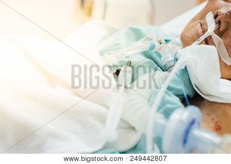 Patient Do Tracheostomy And Ventilator In Hospital