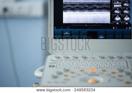 On The Screen Of The Ultrasound Apparatus, The Scan Of The Left Ventricle Of The Heart In The Positi