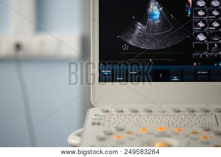 On The Screen Of The Ultrasound Device, A Heart Scan In A Four-chamber Position With A Demonstration