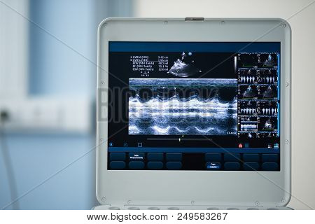 On The Screen Of The Ultrasound Apparatus, The Scan Of The Left Ventricle Of The Heart In The Positi