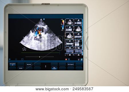 On The Screen Of A Modern Ultrasound Scanner, An Image Of The Heart Cavities With Red And Blue Strea