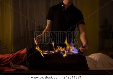 Chinese Fire Massage - Huo Liao Therapy. Traditional Chinese Medicine, Fire Treatment And Bodycare C