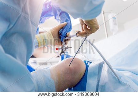 Arthroscope Surgery. Orthopedic Surgeons In Teamwork In The Operating Room