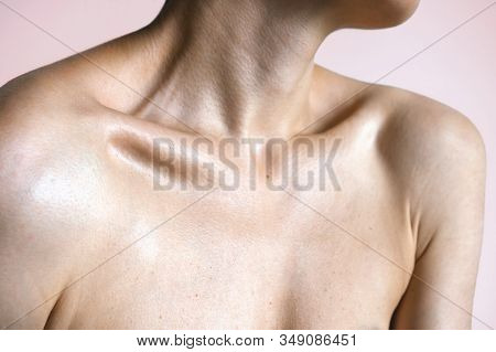 Female Graceful Forms. Neck Shoulders And Collarbones Of A Beautiful Woman Age 35. Beauty And Skin C