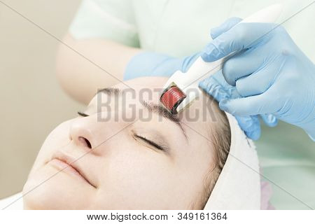 The Woman Undergoes The Procedure Of Medical Micro Needle Therapy With A Modern Medical Instrument D