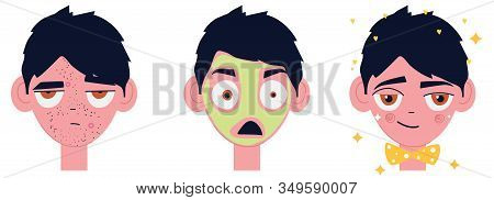 A Set Of Skin Images With Black Dots And Pimples, Mask Application And Clean Skin. Emotional Vector 