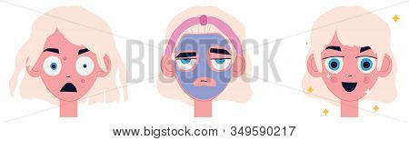 A Set Of Images About Problem Skin With Pimples, Application Of An Acne Mask, And Clean Skin. Emotio