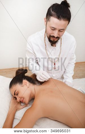 Reflexologist Doing An Acupuncture Procedure. Stress Relief With Acupuncture. Traditional Chinese Me