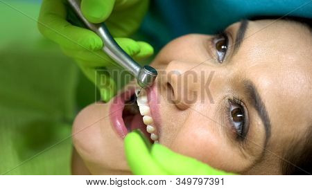 Dentist Preparing To Drill Central Incisor Preparing Tooth For Sealant Placement