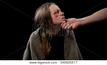 Husband Hand Taking Wife Face With Wounds, Marital Mistreatment, Aggression