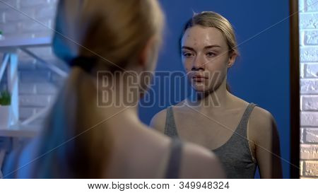 Upset Teenager Crying While Examining Problem Face Skin In Front Of Mirror, Acne