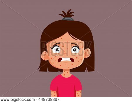Little Girl Suffering From Measles Vector Cartoon Illustration