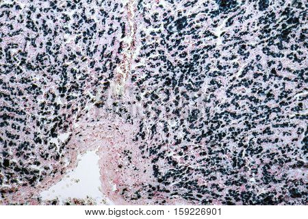 micrographic shot showing the cross section of a human liver
