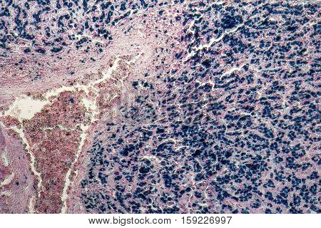micrographic shot showing the cross section of a human liver