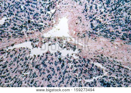 micrographic shot showing the cross section of a human liver
