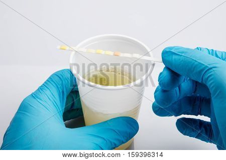 Close-up Of Medical Urine Test Examined By Doctor In Clinic