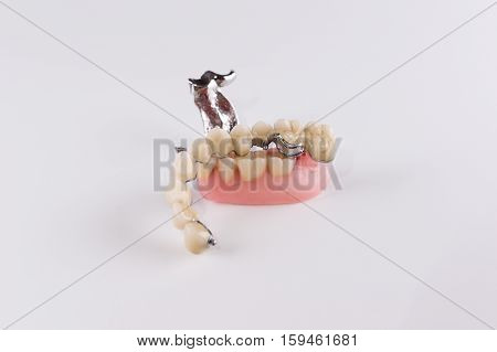 Clasp prosthesis with and attachments fixing ceramic crowns