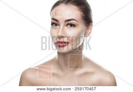 Portrait Of A Beautiful Woman On A White Background, On The Face Are Visible Areas Of Problem Skin -