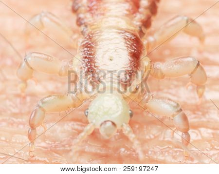 3d rendered medically accurate illustration of a head louse on human skin