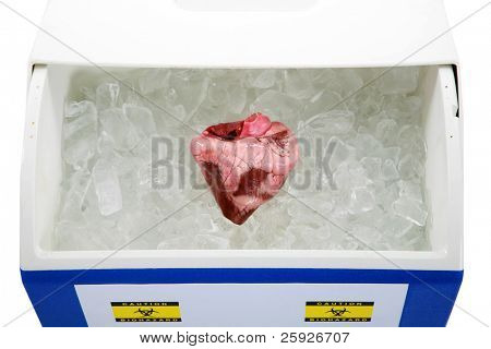 인간의 마음에서 장기 기증자 이식 준비 얼음 가슴에 얼음 침대에 낳는다. 격리