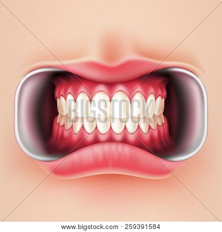 Vector Dental Braces, Oral Brakets System 3d